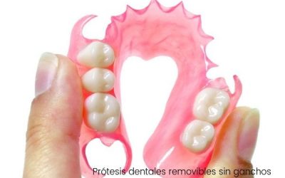 Prótesis dentales removibles sin ganchos