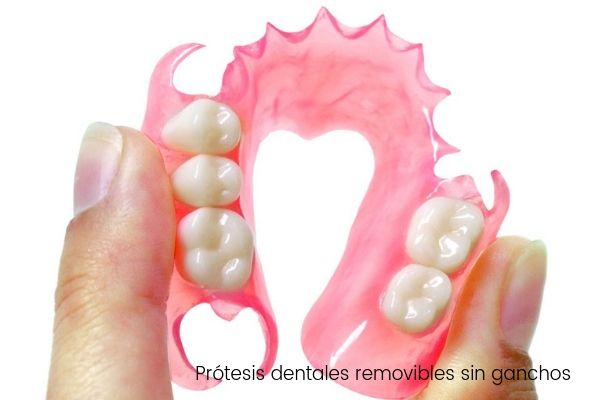 Prótesis dentales removibles sin ganchos