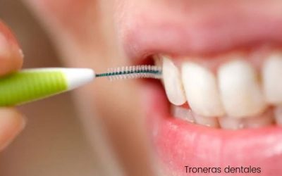 Troneras gingivales: ¿por qué aparecen triángulos negros entre los dientes?