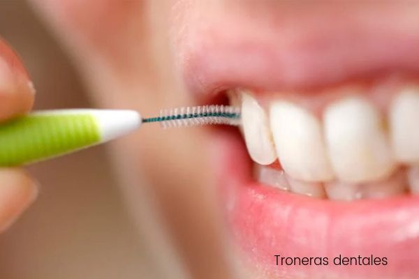 Troneras gingivales: ¿por qué aparecen triángulos negros entre los dientes?